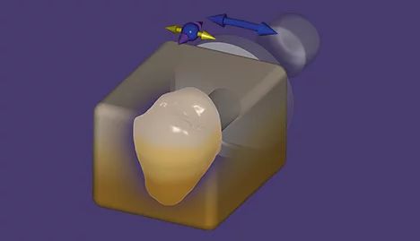 exocad - moduł zagnieżdżania w CAD